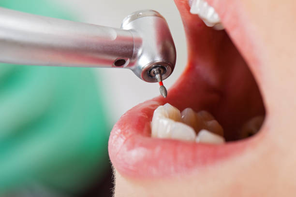 Best Emergency TMJ Treatment in Mount Pleasant, IA